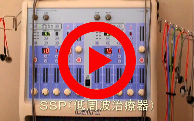 (理学療法) SSP(低周波治療器)